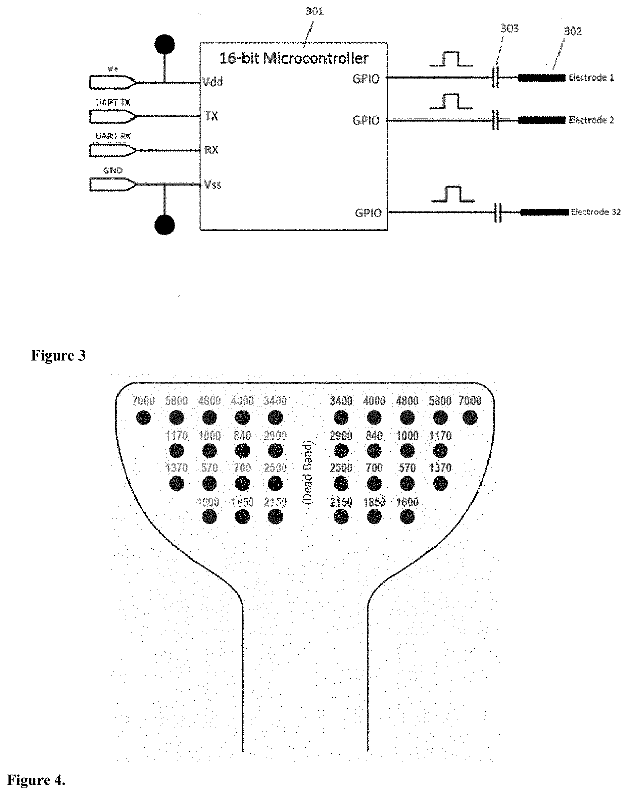 Method and apparatus for treating a neurological disorder