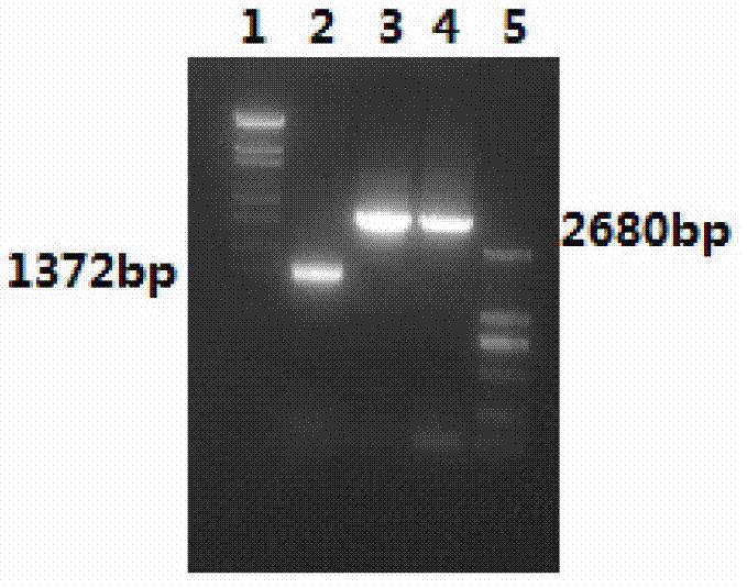 Immunogenic fusion protein for tuberculosis and application of immunogenic fusion protein