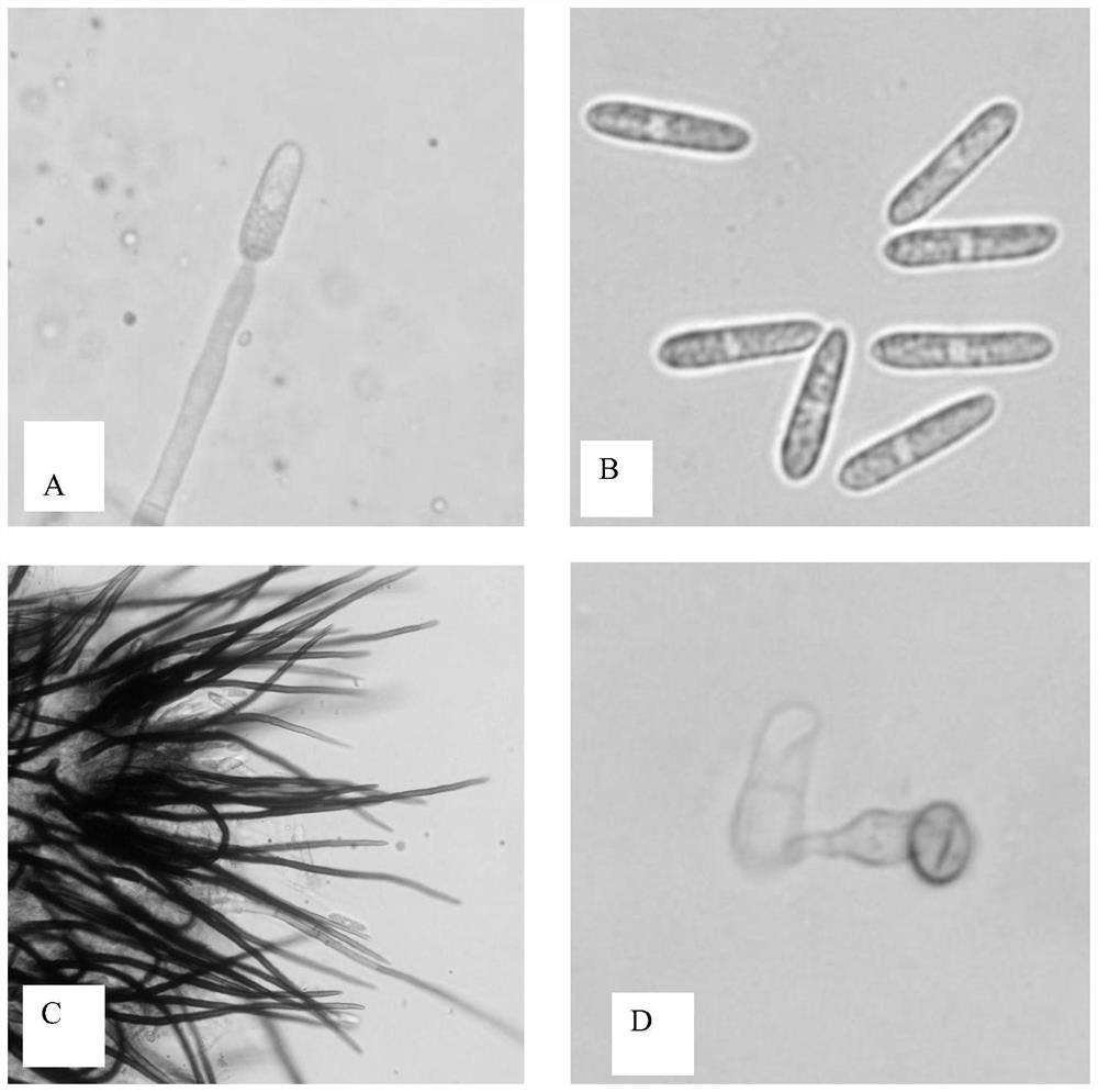 Induced destruction of anthracnose spore-forming medium, preparation method and method for inducing spore-forming