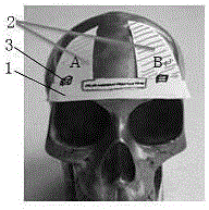 Adjustable arc-shaped forehead part pattern guide plate