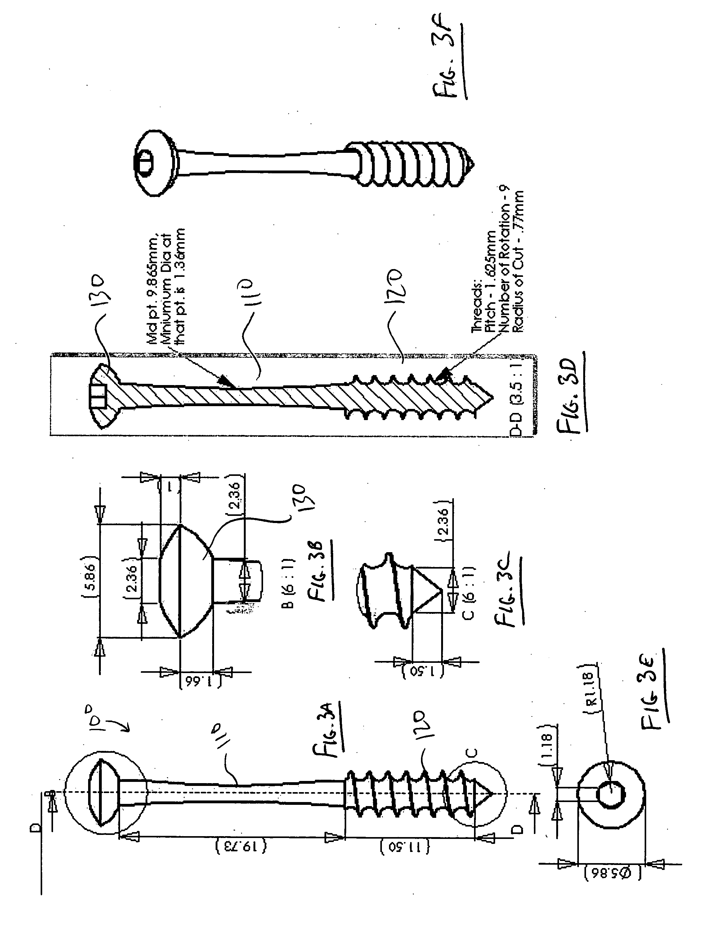 Osteosynthetic implants and methods of use and manufacture