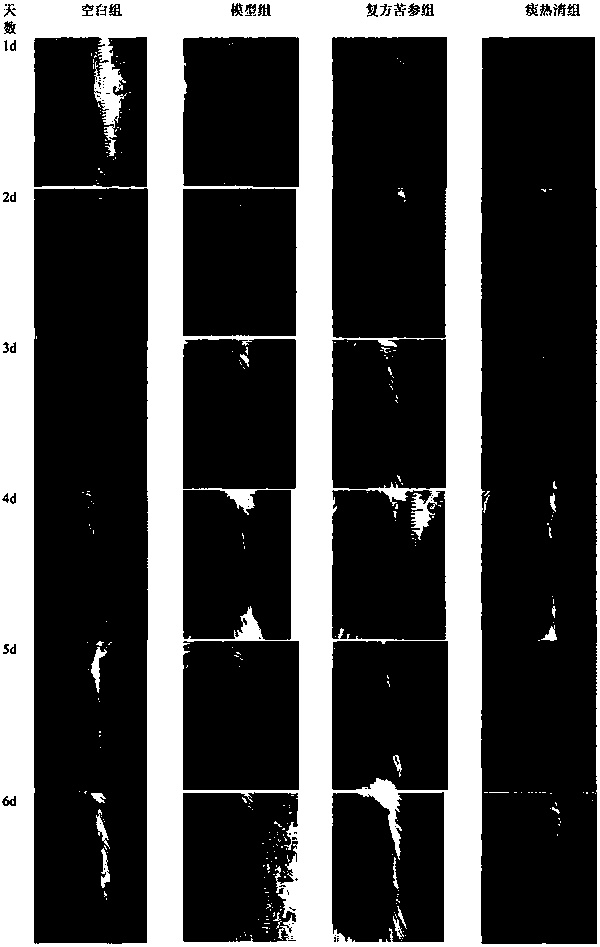 Novel pharmaceutical use of Tanreqing