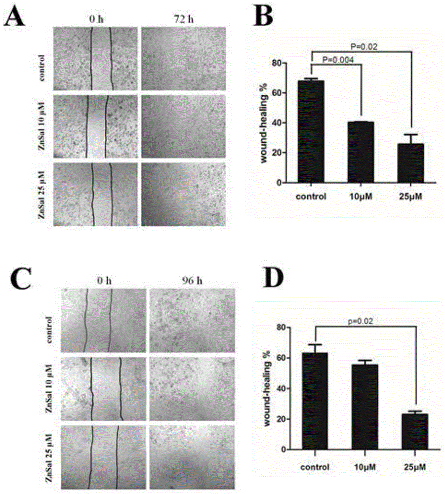 Application of zinc salicylate dihydrate in preparing medicine for treating breast cancer