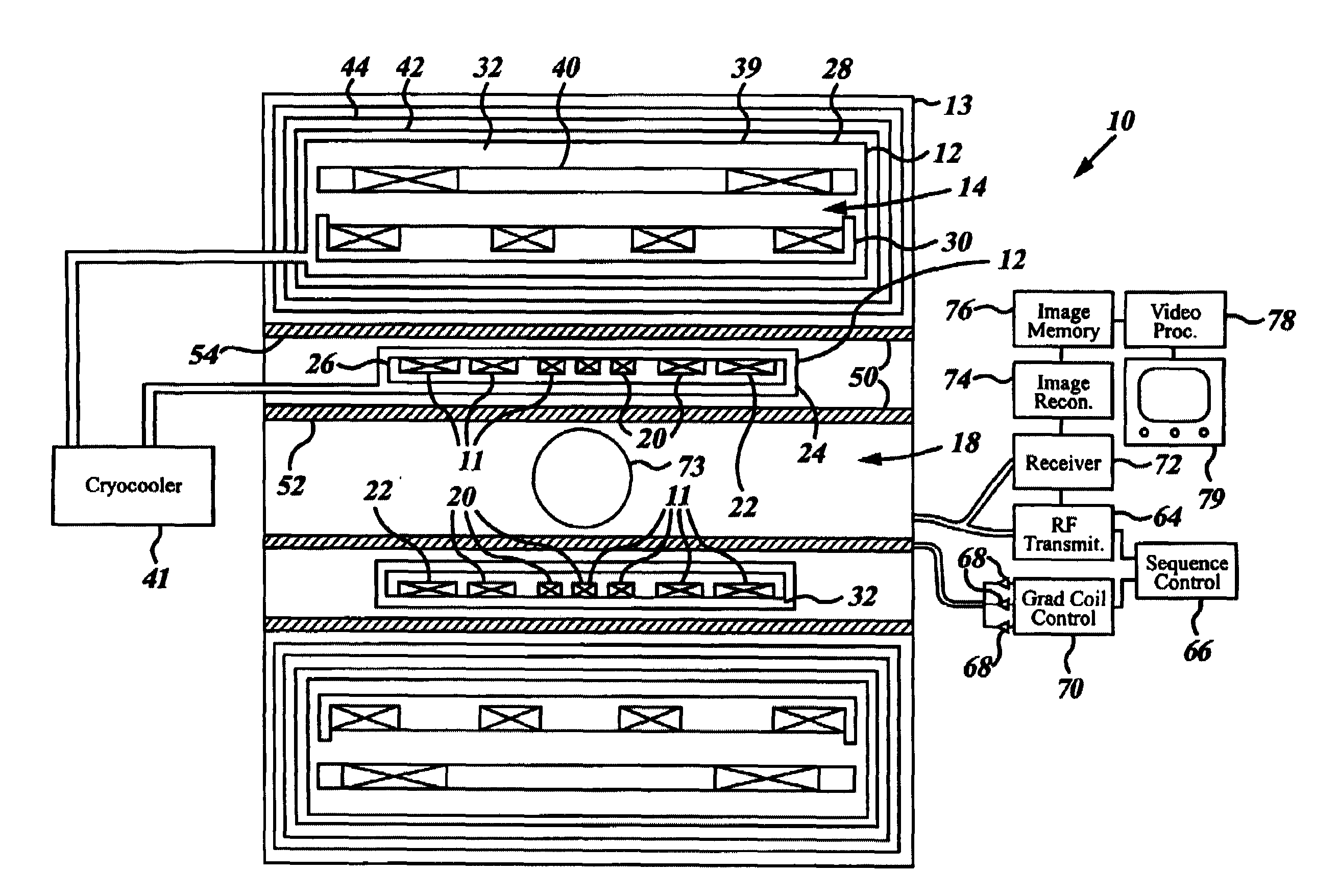 MRI system utilizing supplemental static field-shaping coils