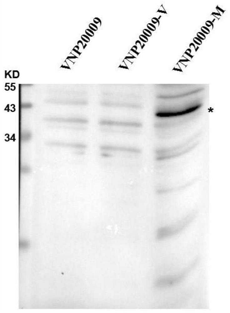 Application of attenuated salmonella typhimurium and genetically engineered bacteria thereof in preparation of medicine for treating acute leukemia