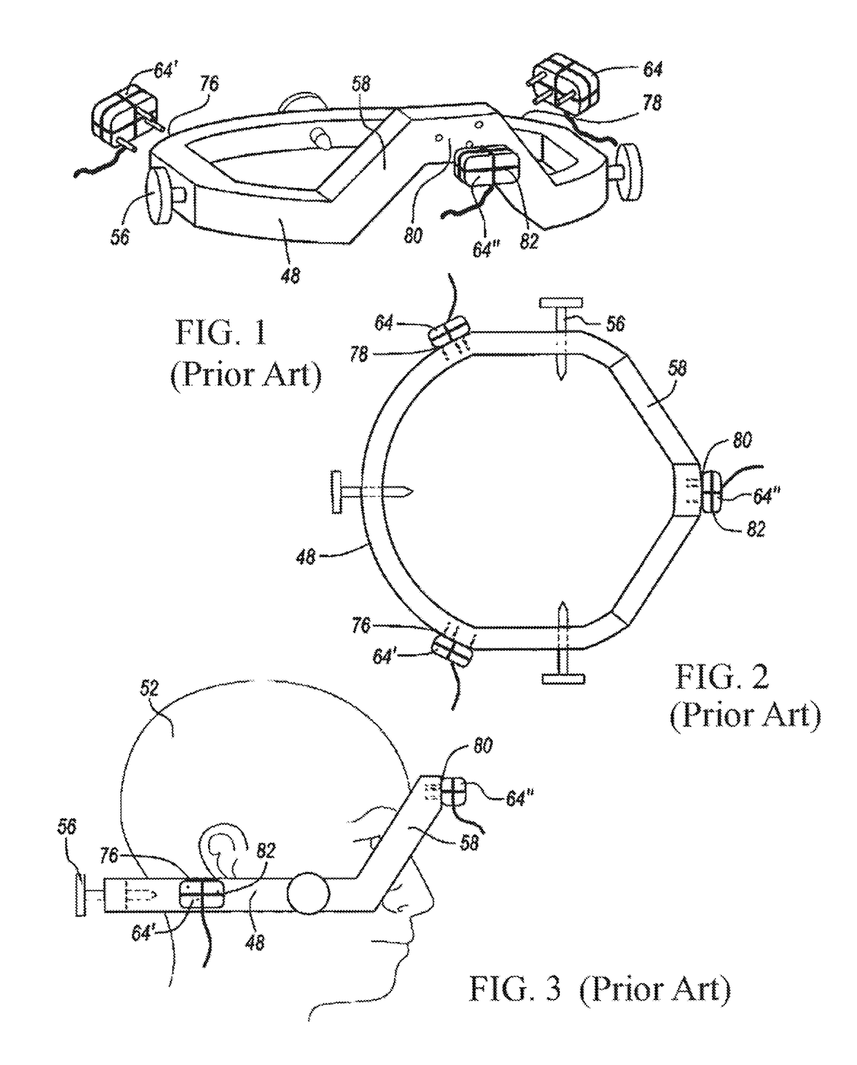 Method and device for positioning and stabilization of bony structures during maxillofacial surgery