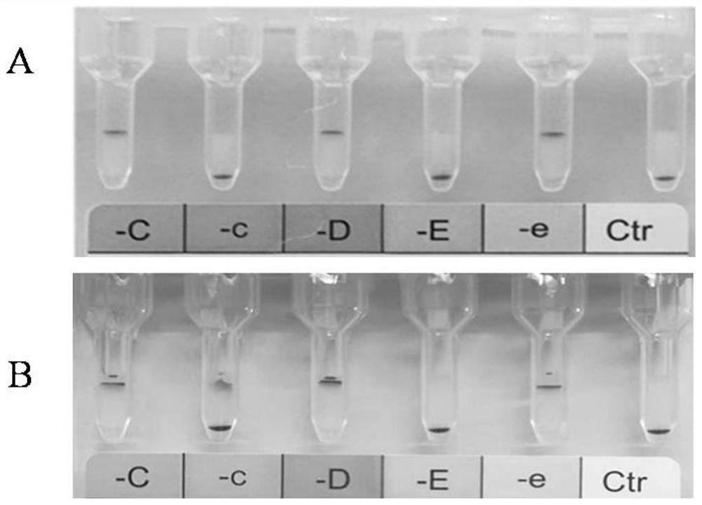 A kind of medium for separating old and new red blood cells and its preparation method and application