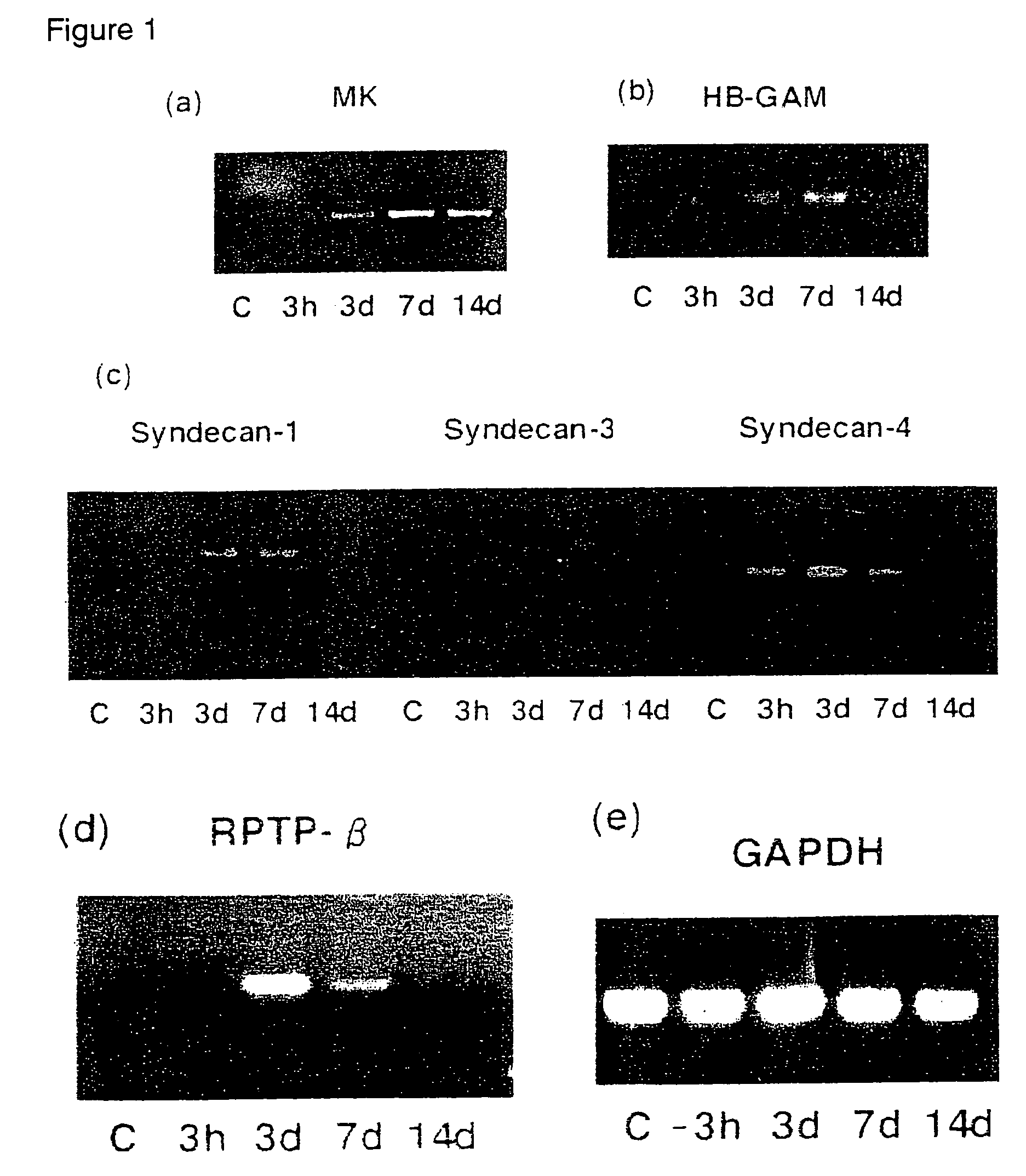 Pharmaceutical compositions for the prevention and treatment of atherosclerosis and restenosis after PTCA