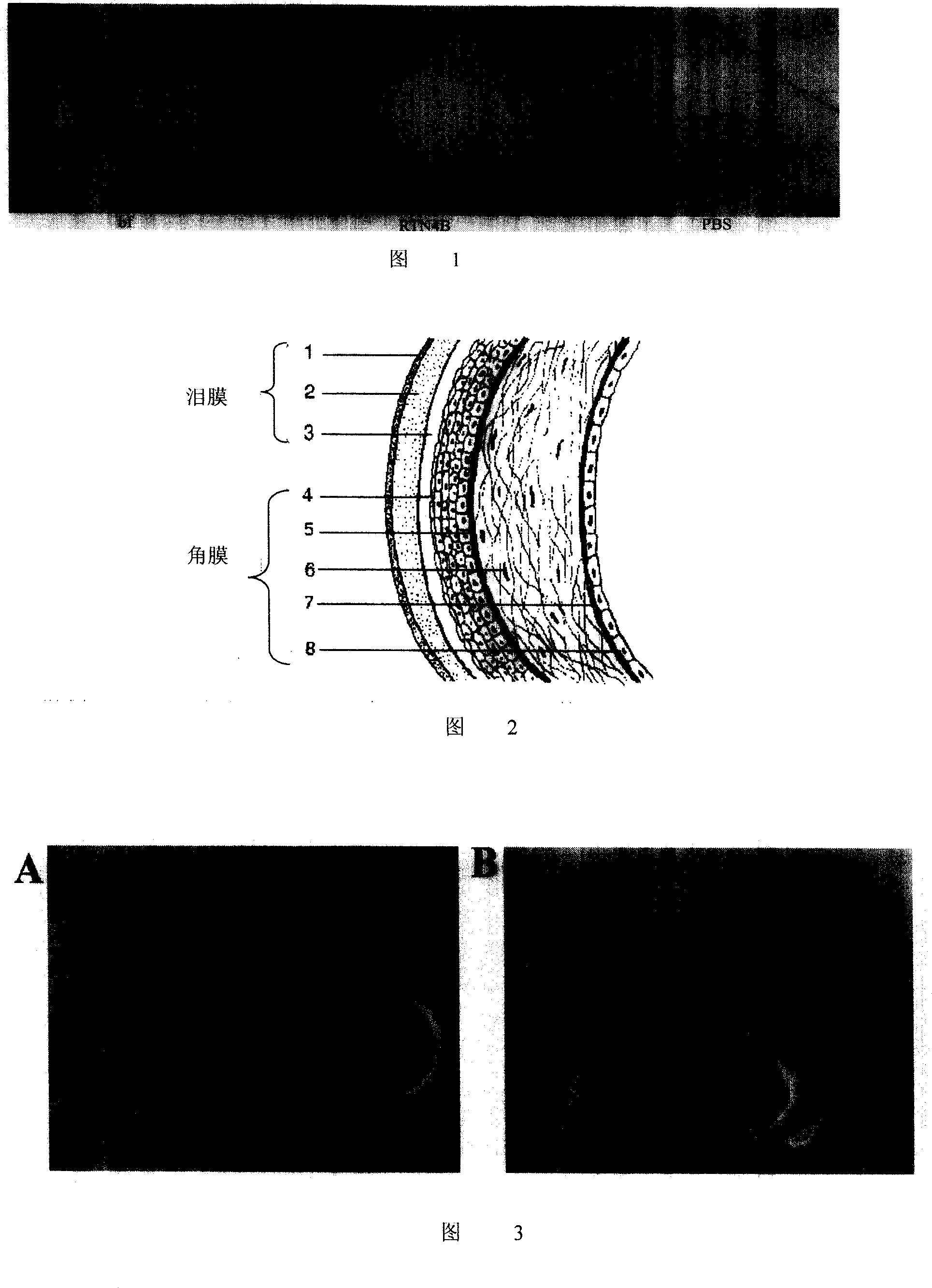 Application of human RTN4B protein in preparation of medicine for healing wound