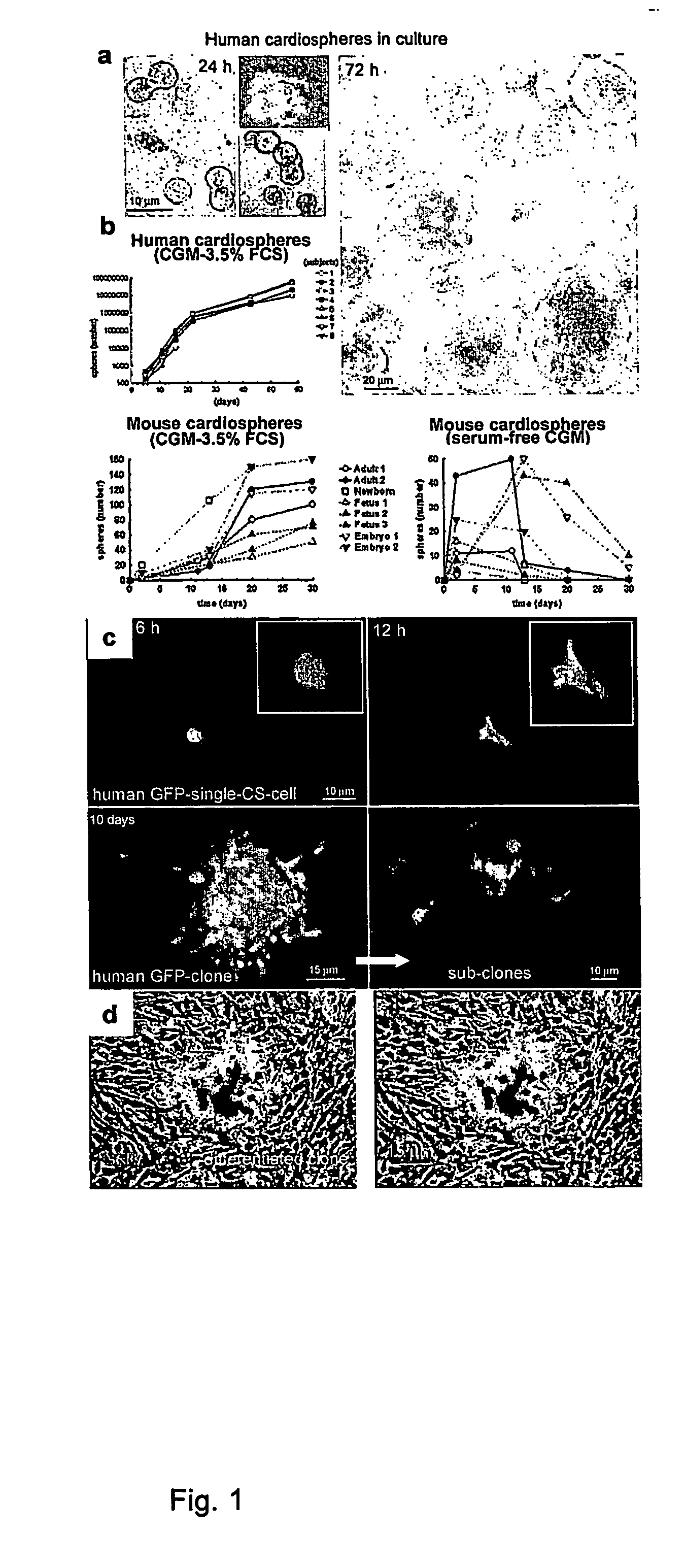 Method for the isolation and expansion of cardiac stem cells from biopsy