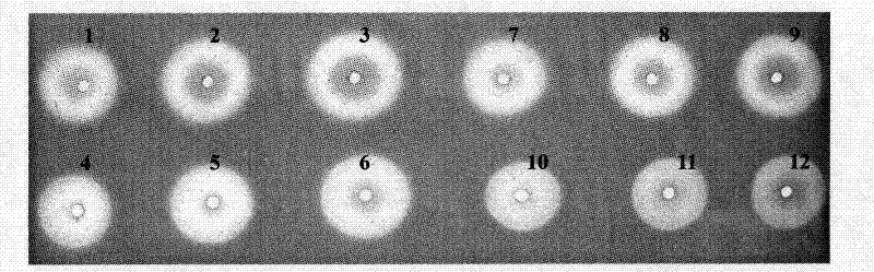 Application of earthworm fibrinolytic enzyme in resistance to liver fibrosis