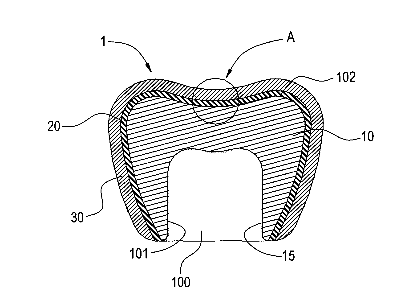 Oral dental material structure with high chaining force