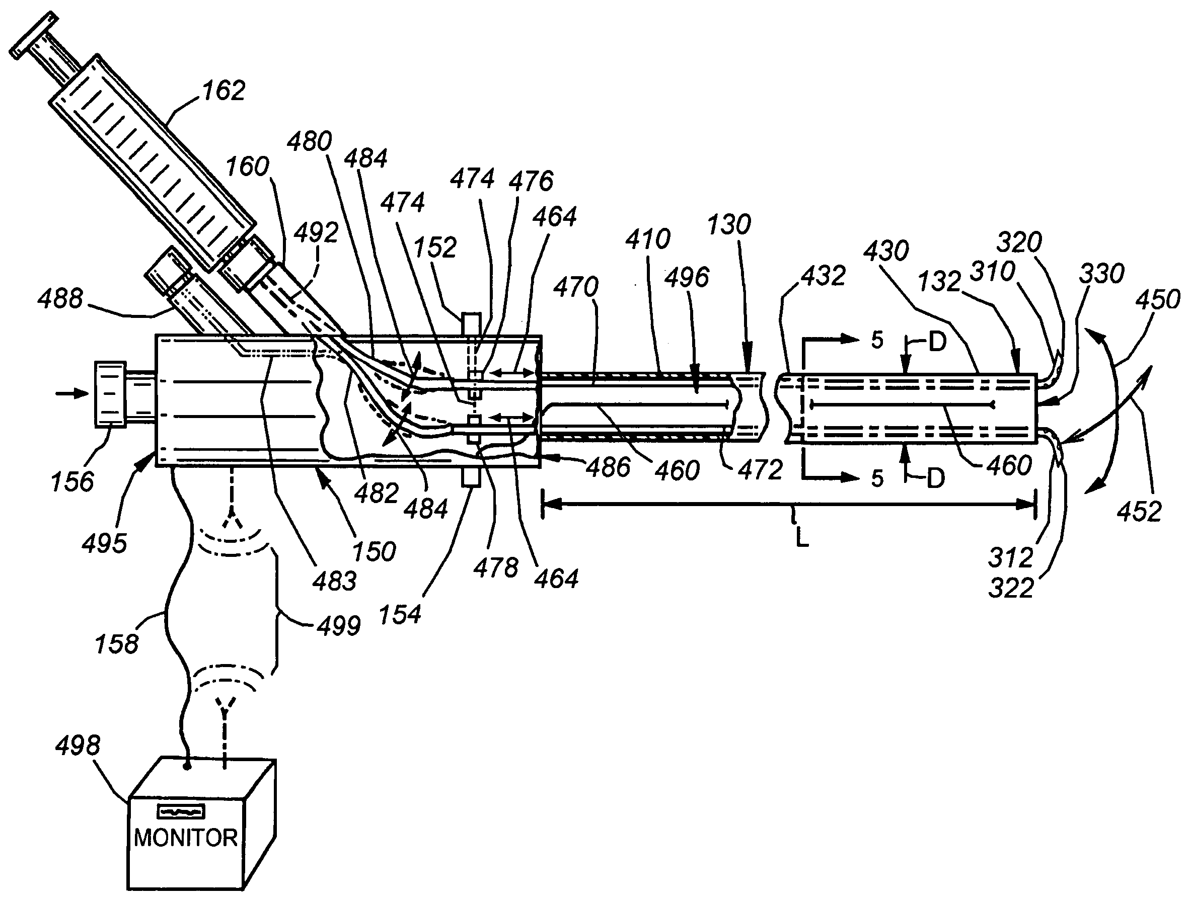 Catheter for introduction of medications to the tissues of a heart or other organ