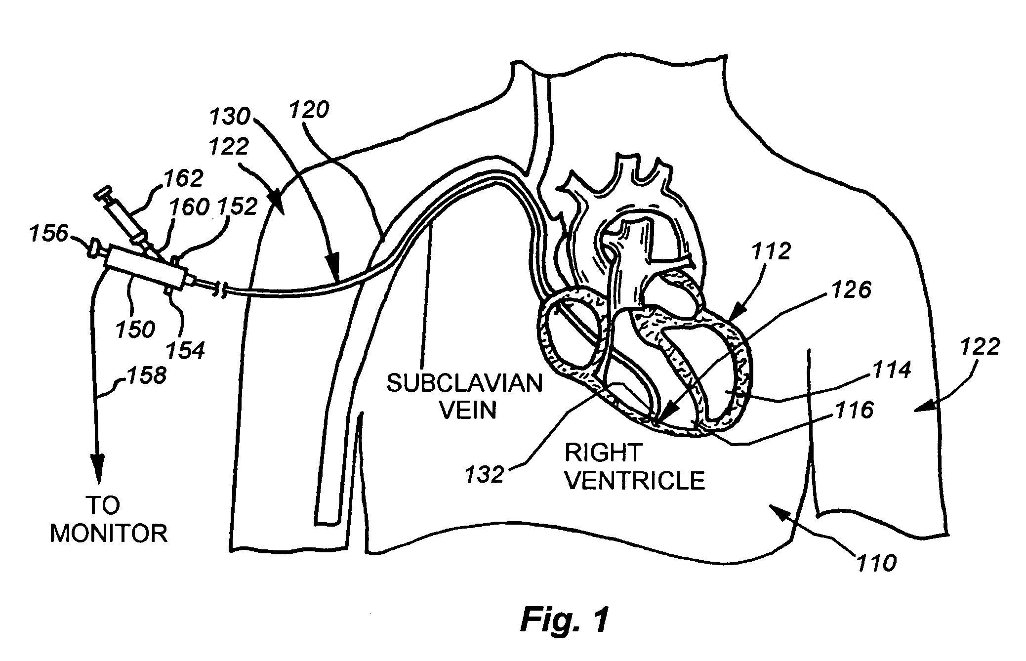 Catheter for introduction of medications to the tissues of a heart or other organ