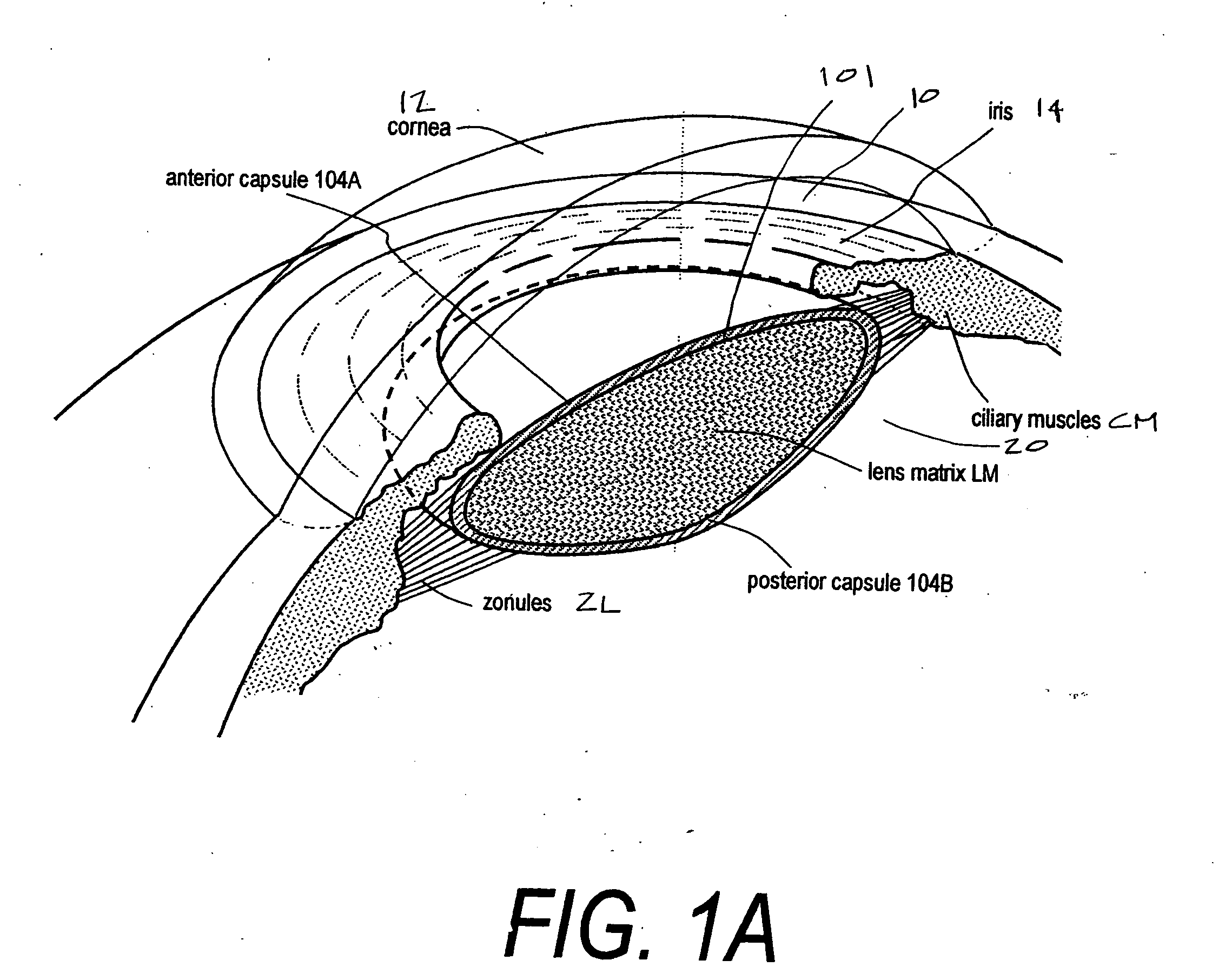 Ophthalmic devices, methods of use and methods of fabrication