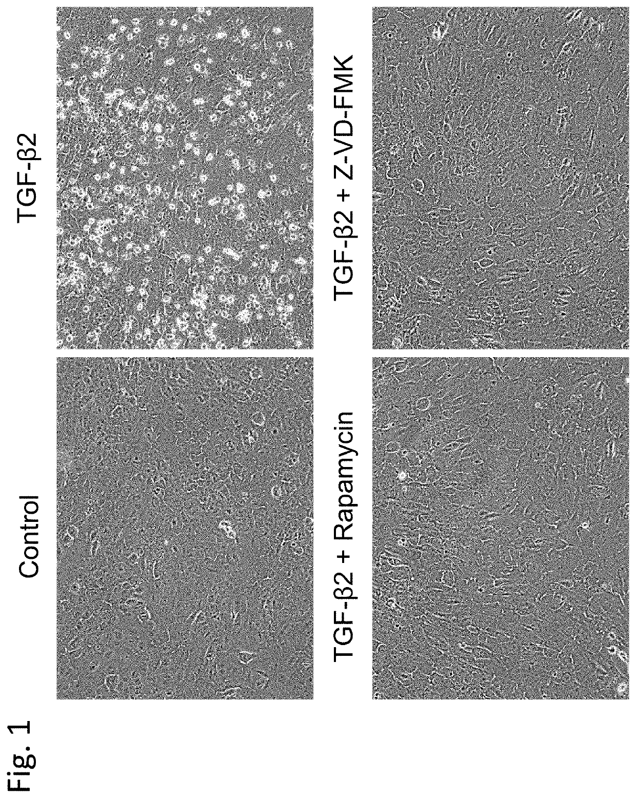 Mtor-inhibitor-containing medicine for treating or preventing ophthalmic symptoms, disorders, or diseases, and application thereof