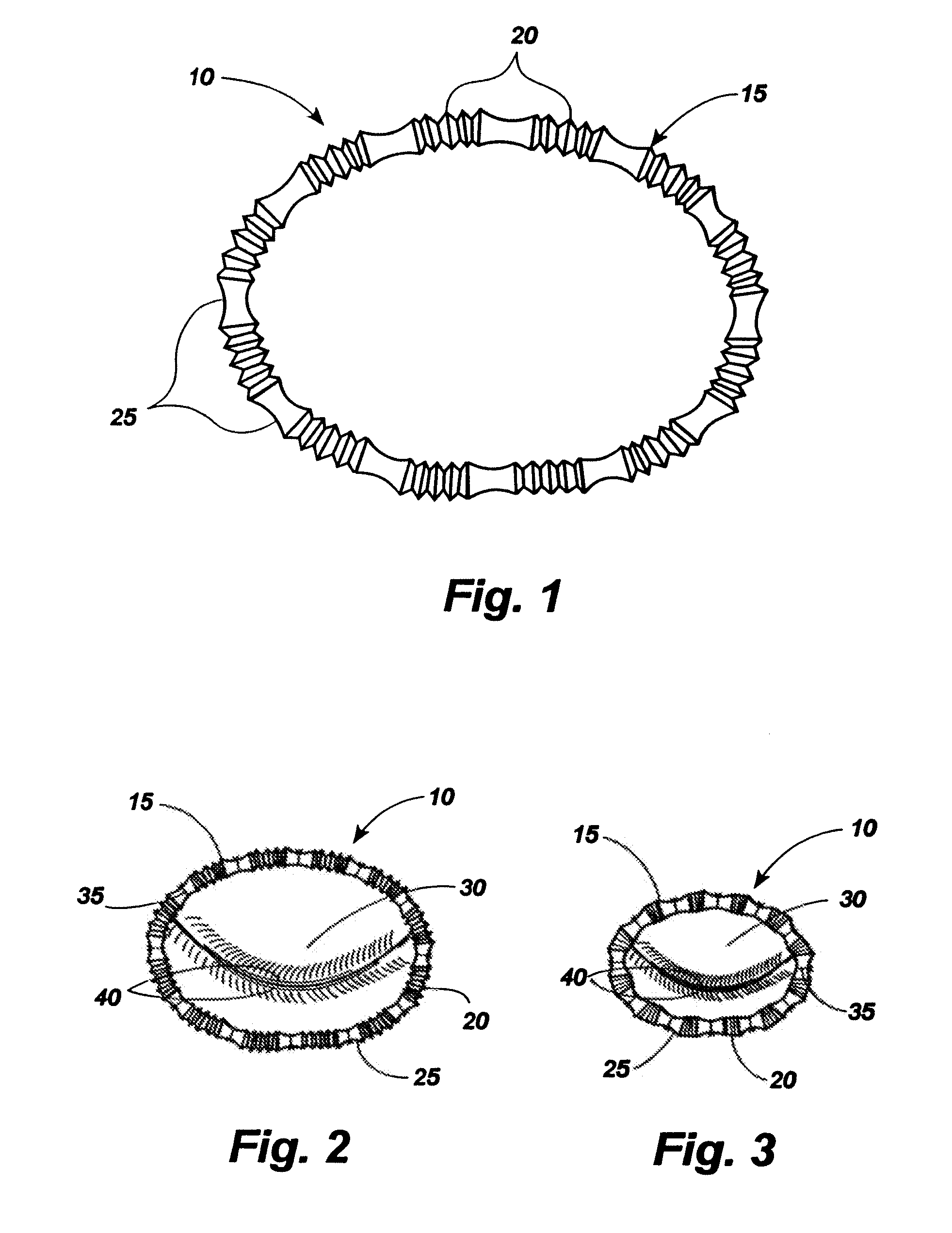 Magnetic docking system and method for the long term adjustment of an implantable device