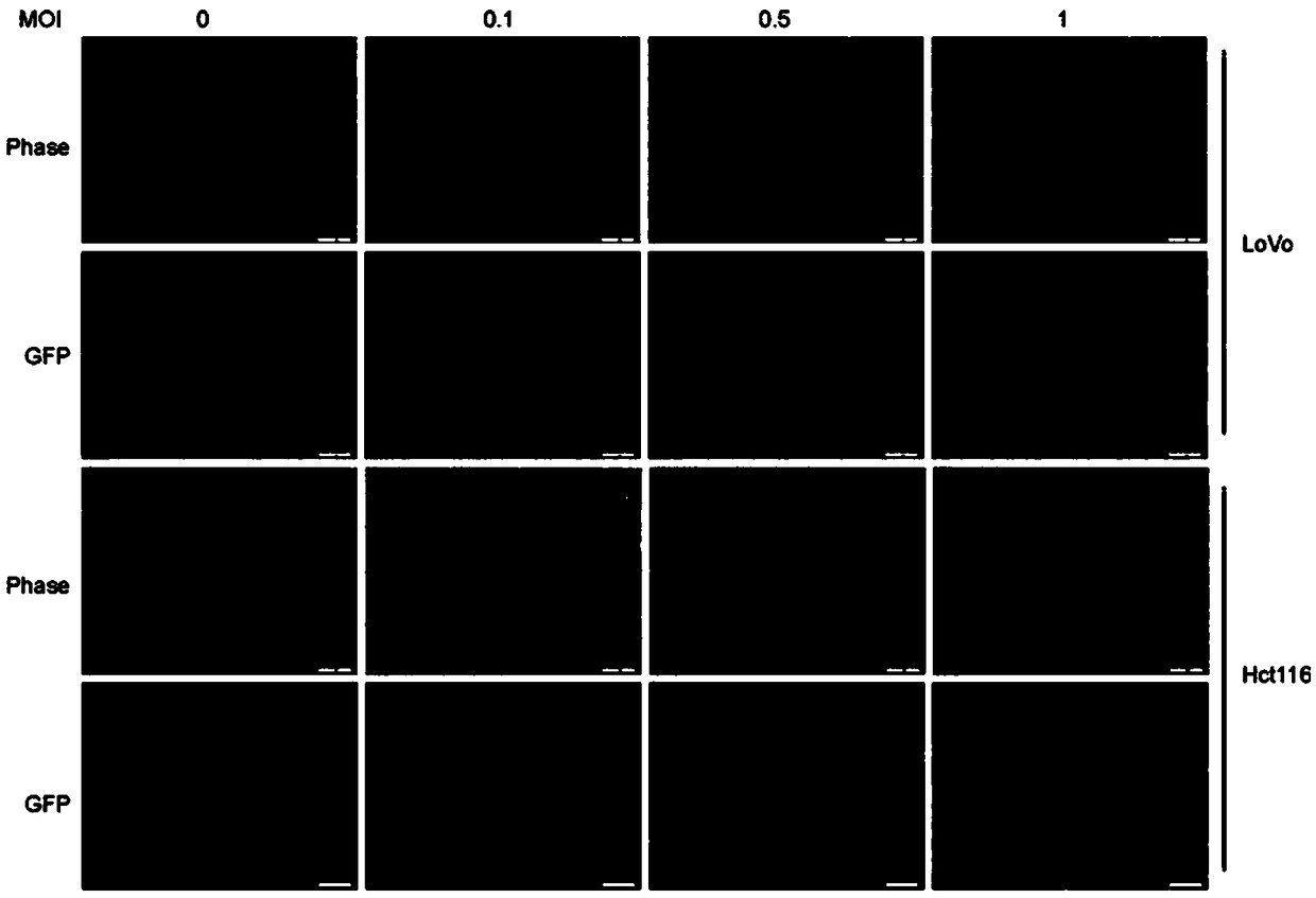 Application of ORFV in preparation of anti-colorectal cancer cell drugs