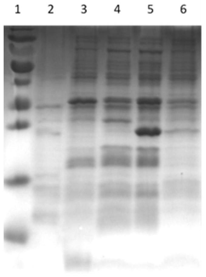 Porcine encephalomyocarditis indirect ELISA diagnosis kit and preparation method thereof