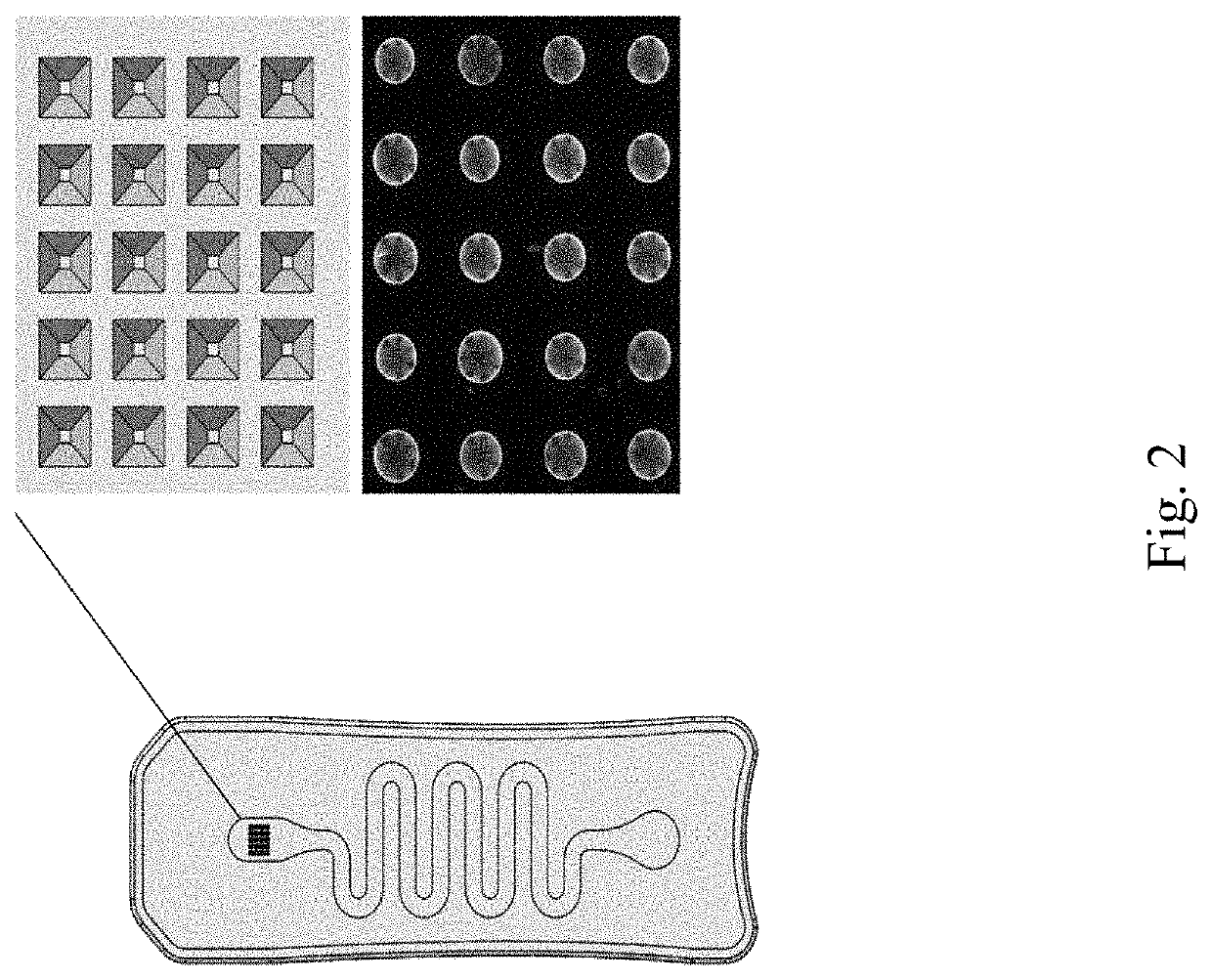 System and Method for Disease Surveillance and Disease Severity Monitoring for COVID-19