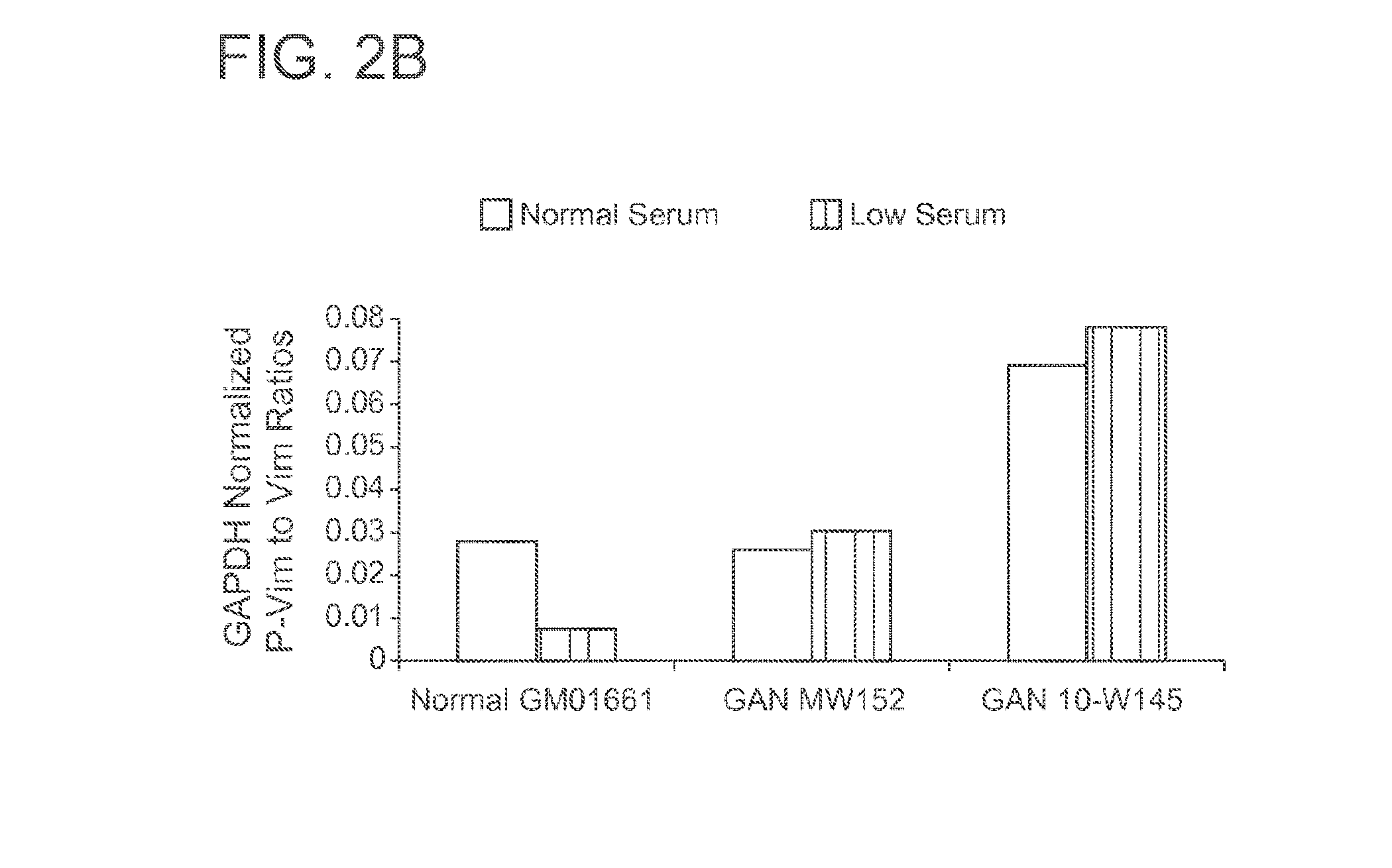 Gigaxonin fusion protein and methods for treating giant axonal neuropathy