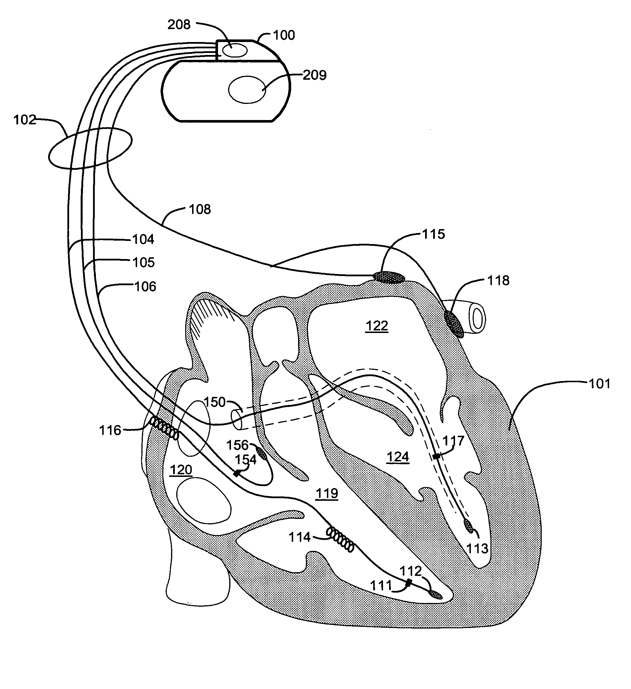 Cardiac response classification using multisite sensing and pacing