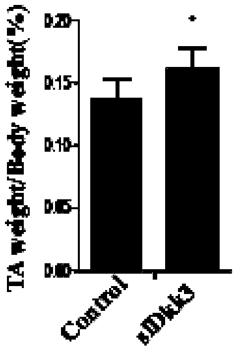 Use of dkk3 gene and related drugs