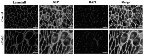 Use of dkk3 gene and related drugs