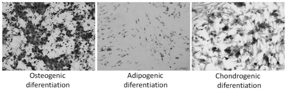 A method for inducing myogenic differentiation of adipose-derived mesenchymal stem cells