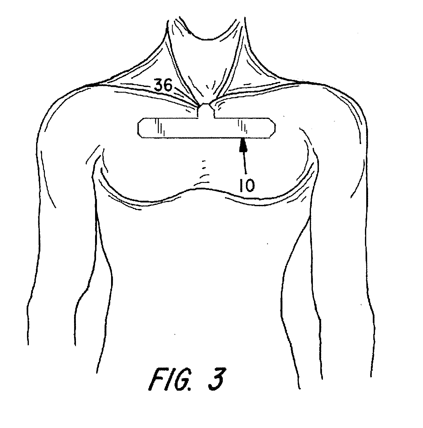 Combination physiologic sensor