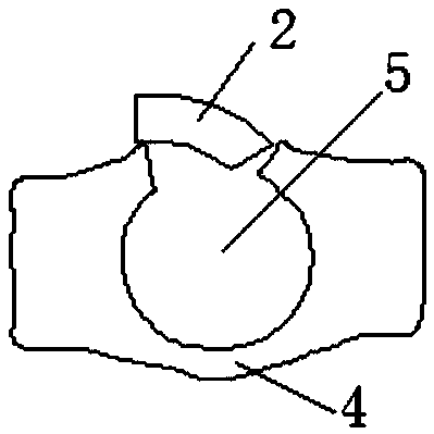 New method of assisting in completing whole process of acetabular posterior wall fracture operation with internal fixing frame system