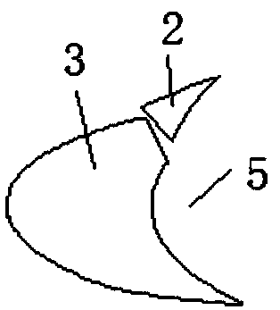 New method of assisting in completing whole process of acetabular posterior wall fracture operation with internal fixing frame system