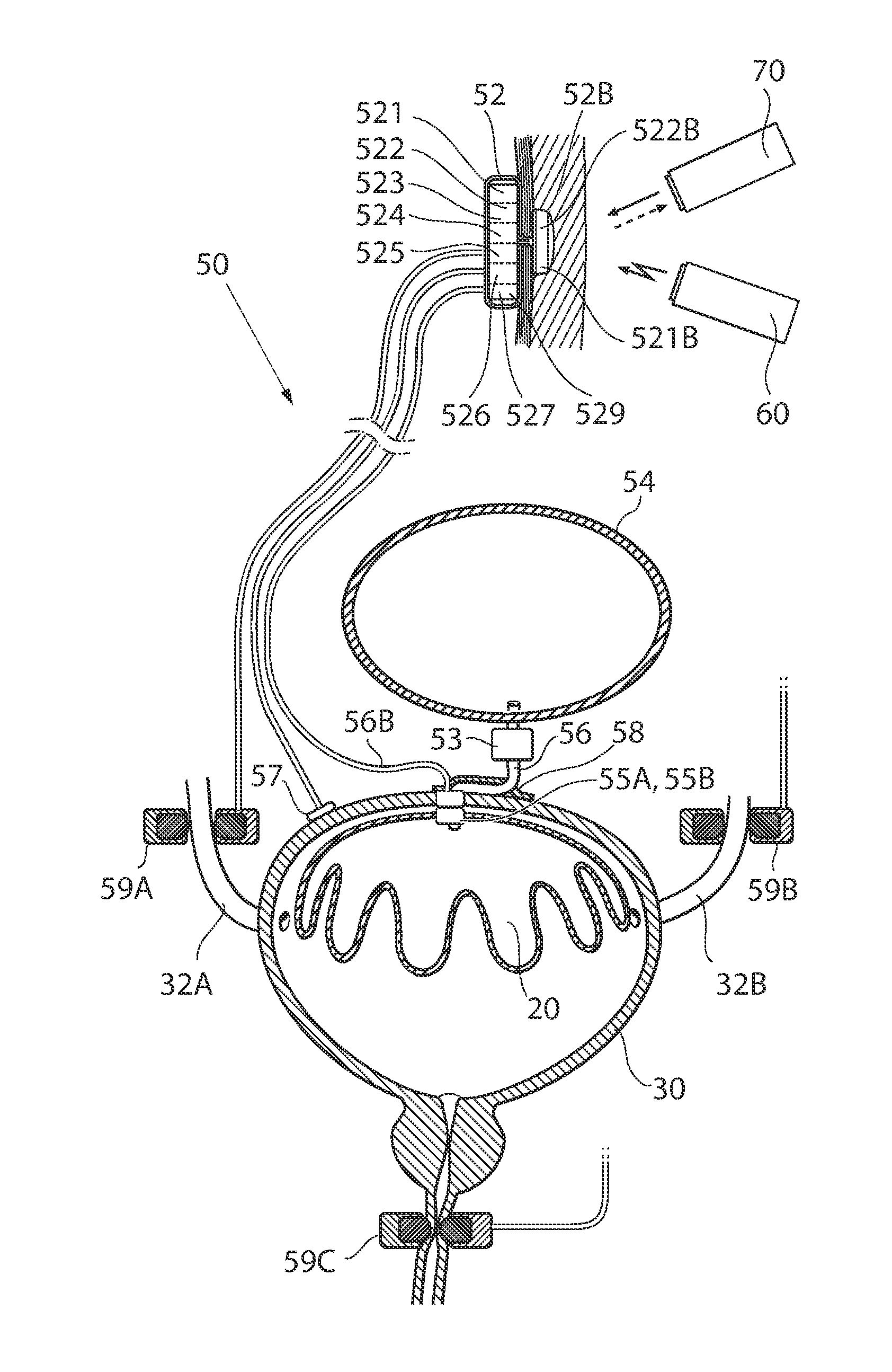 Implantable device for internal urinary control