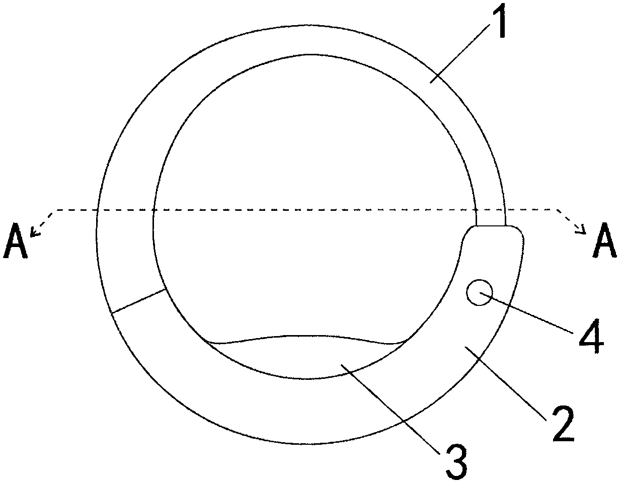 Adjustable contraceptive retaining ring