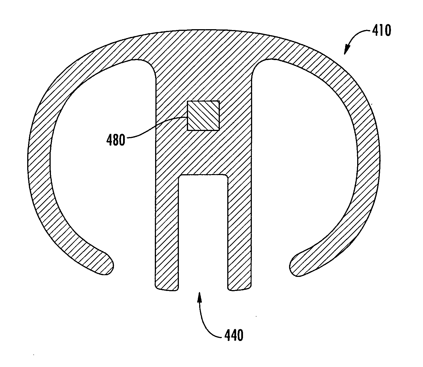 Intraoperative joint force measuring device, system and method