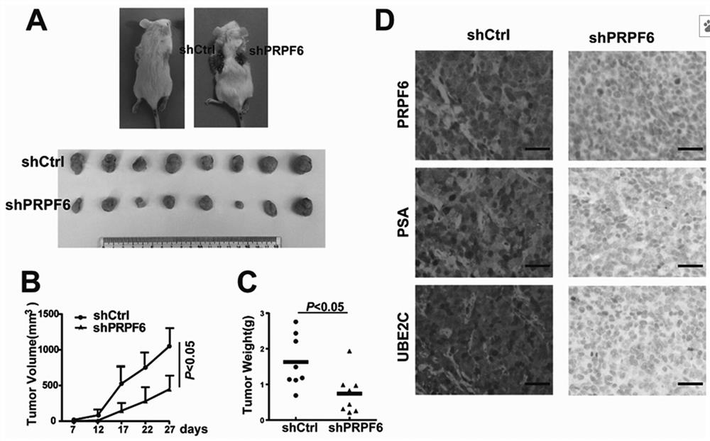 Application of prpf6 in the treatment of prostate cancer and castration-resistant prostate cancer