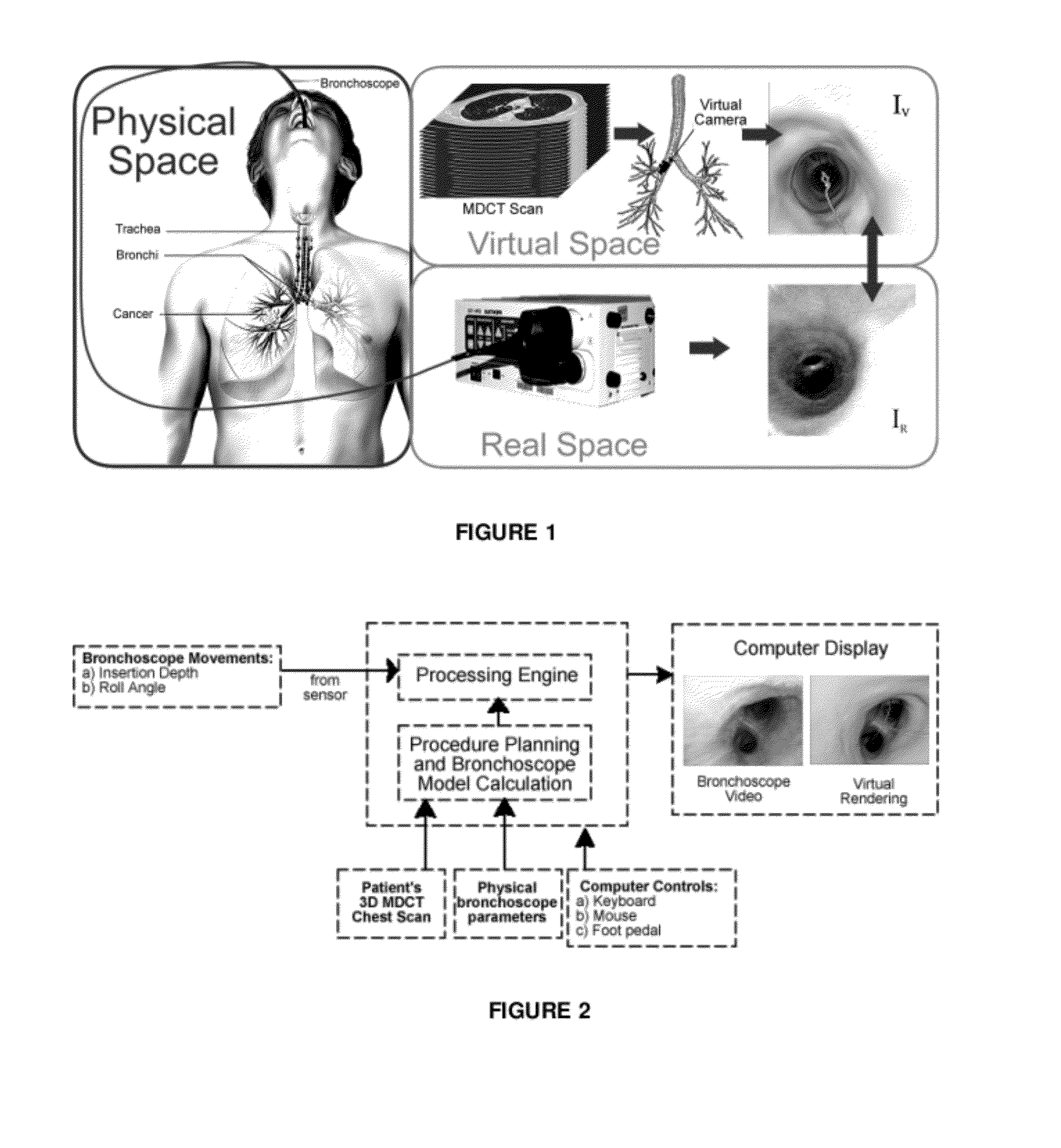 Method and device for determining the location of an endoscope
