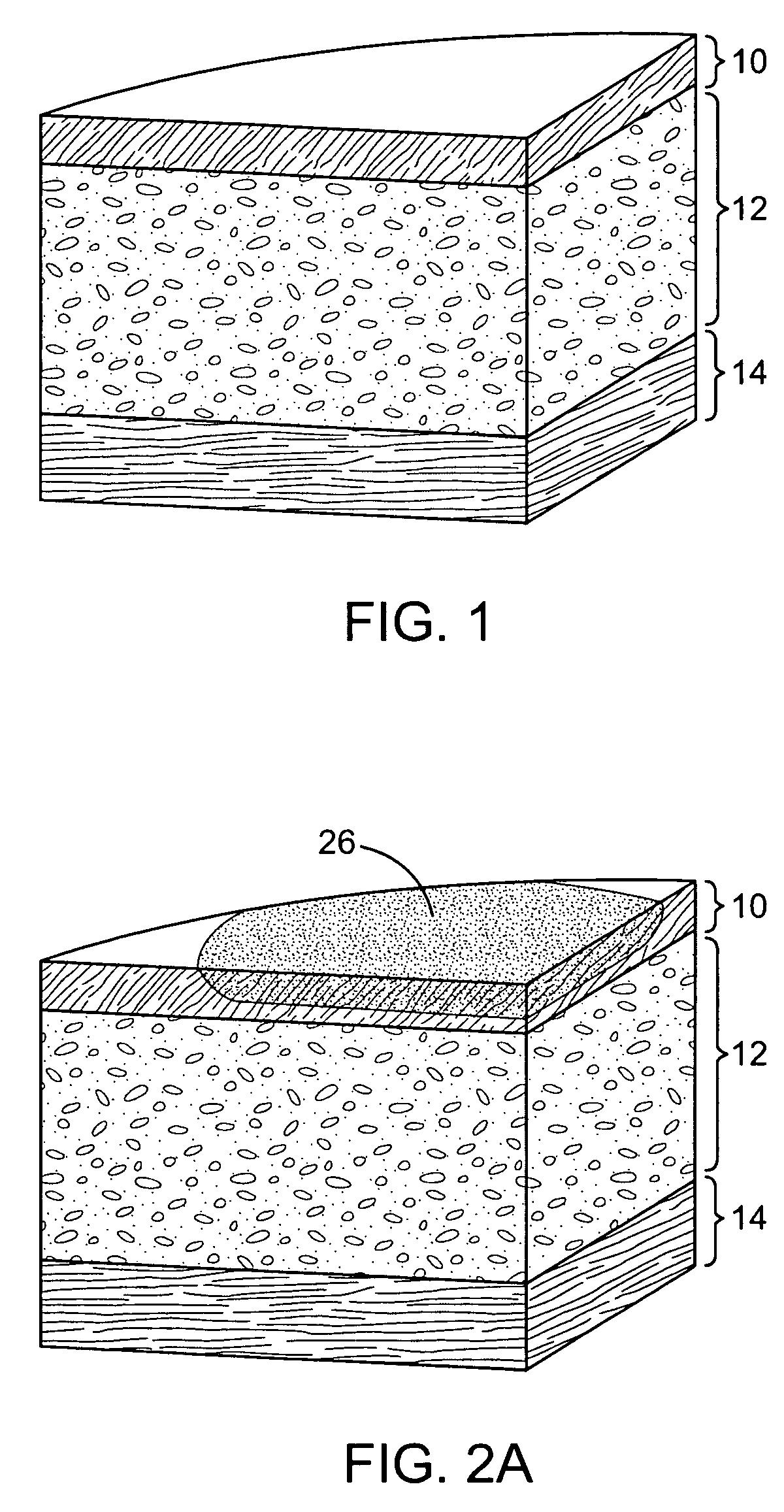 Methods and apparatus for coupling a HIFU transducer to a skin surface