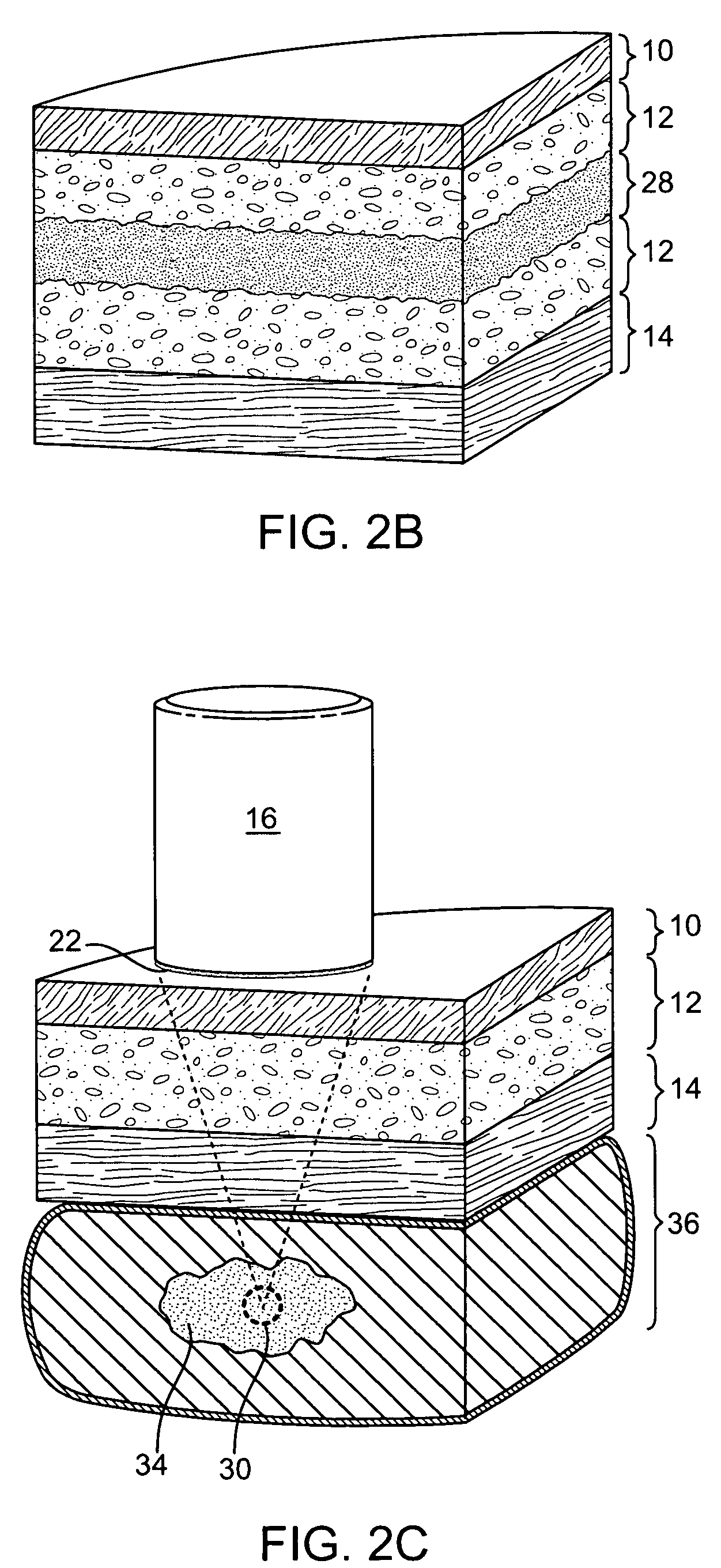 Methods and apparatus for coupling a HIFU transducer to a skin surface