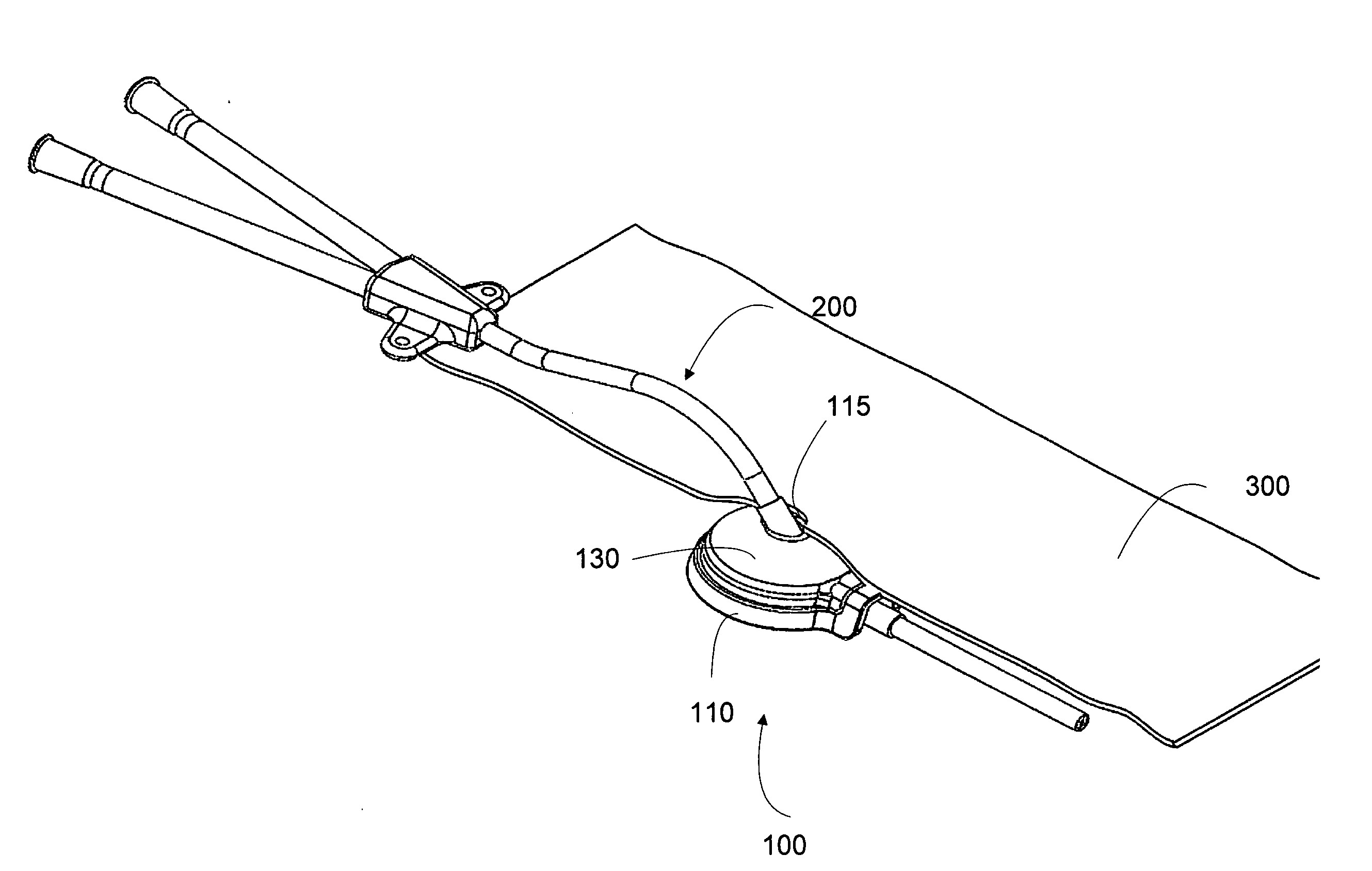 Deformable medical implant