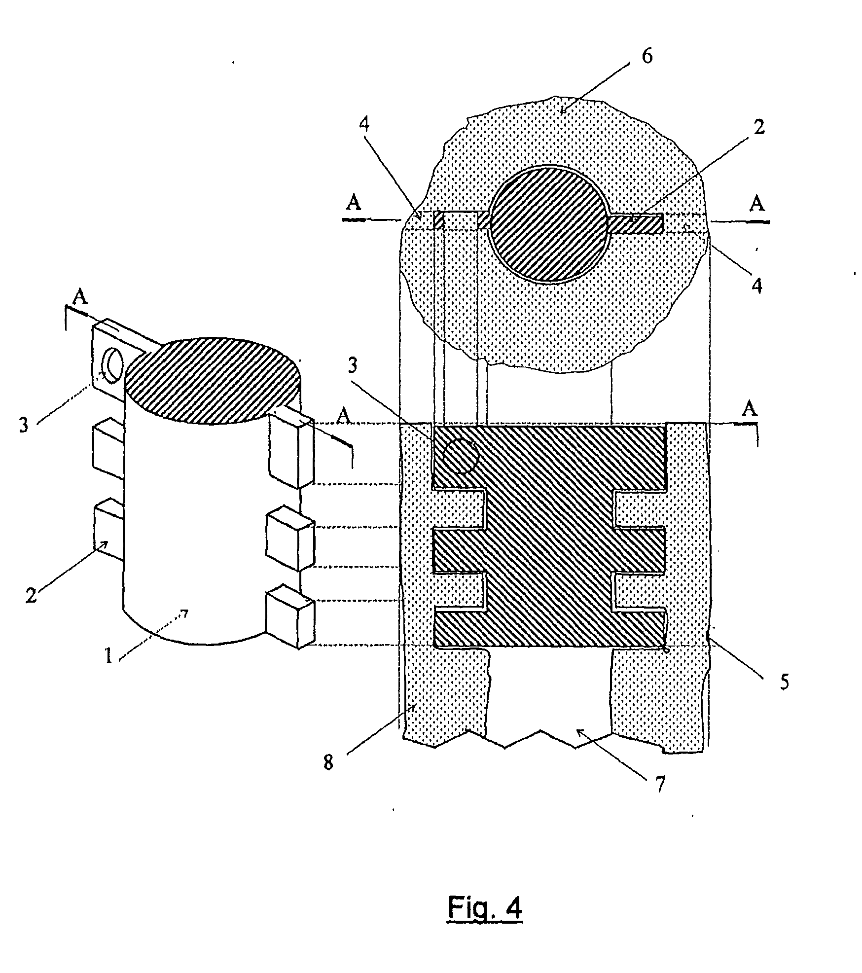 In-bone implantable shaft for prosthetic joints or for direct skeletal attachment of external limb prostheses and method of its installation