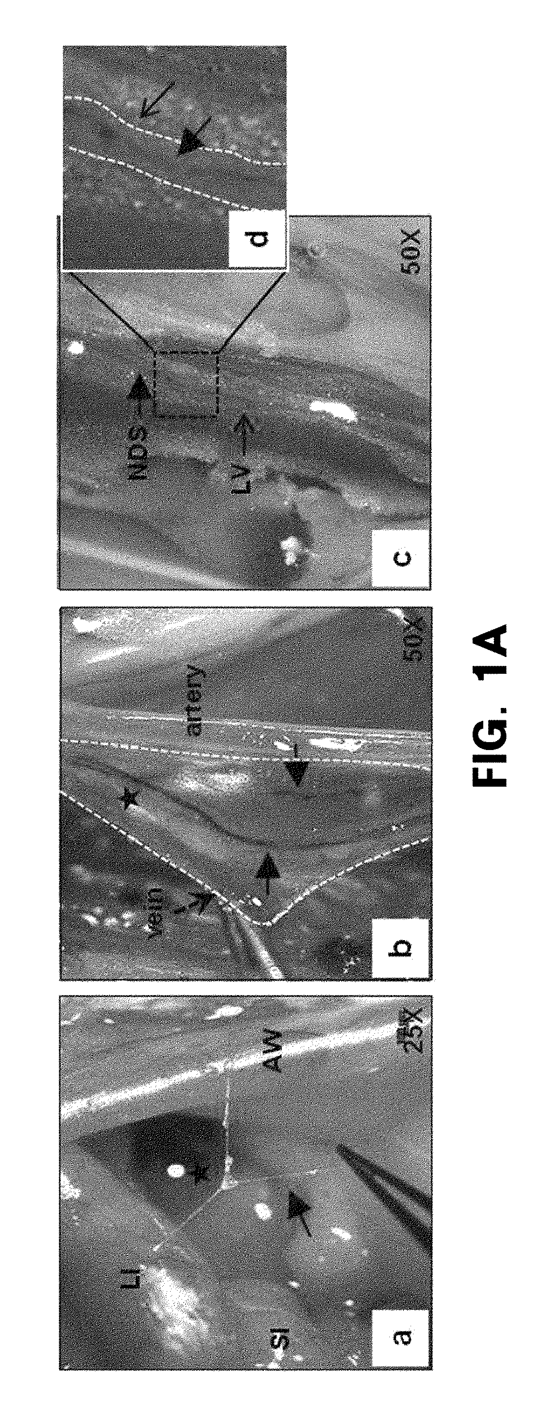 Har-nds-derived stem cells, method for separating same, and use thereof
