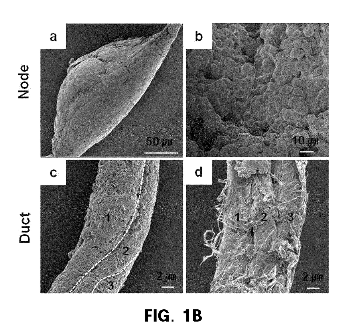 Har-nds-derived stem cells, method for separating same, and use thereof