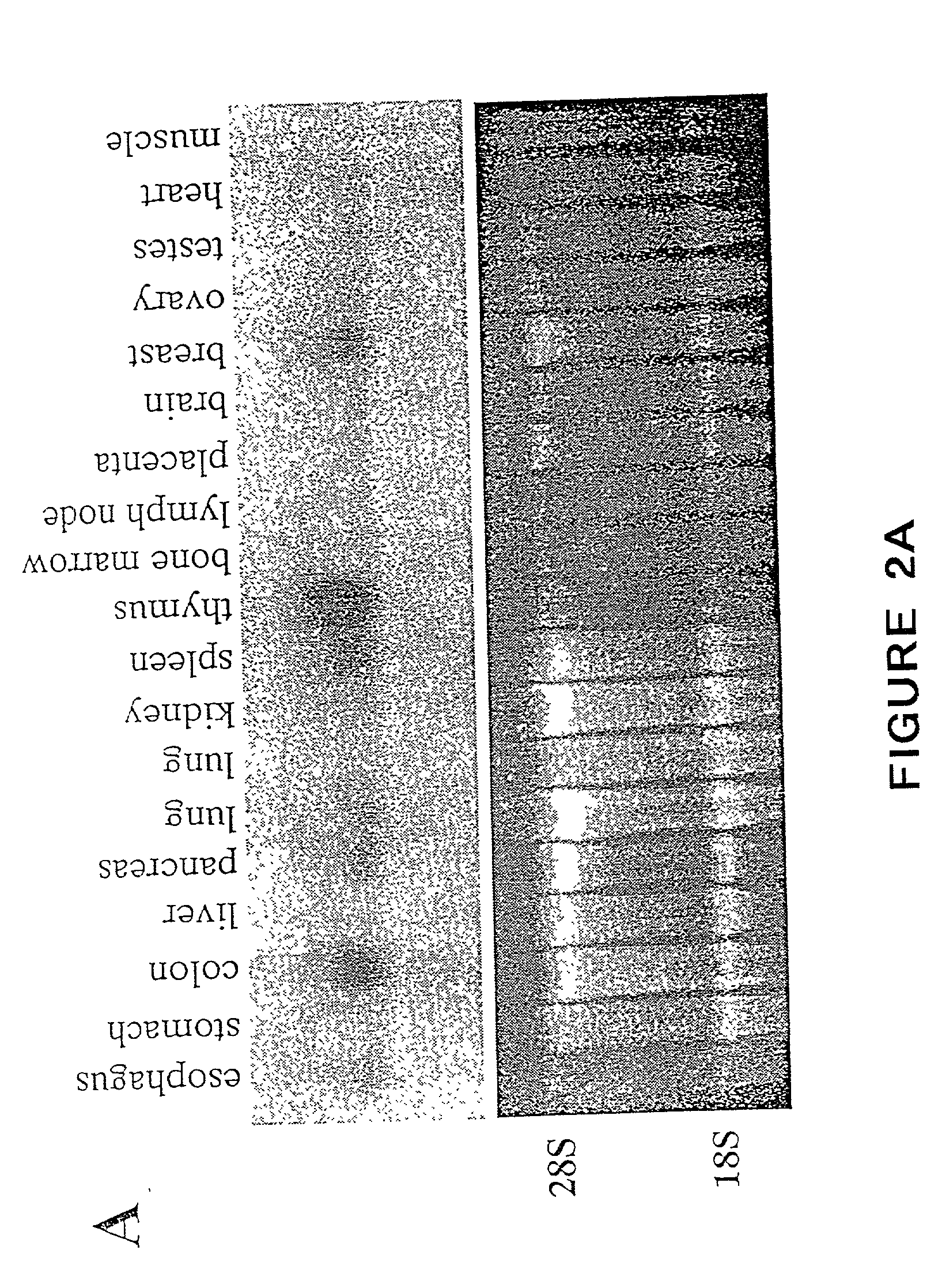 Methods and compositions for diagnosis and treatment of cancer