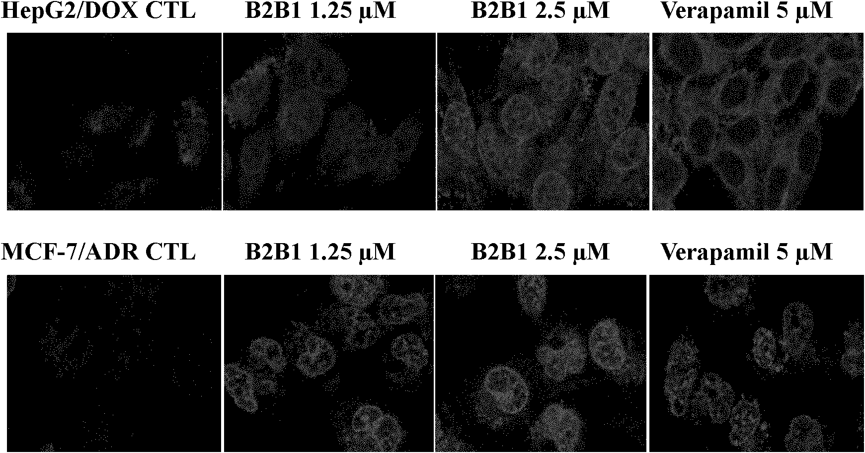 23-hydroxy betulinic acid derivative as well as preparation method and application thereof