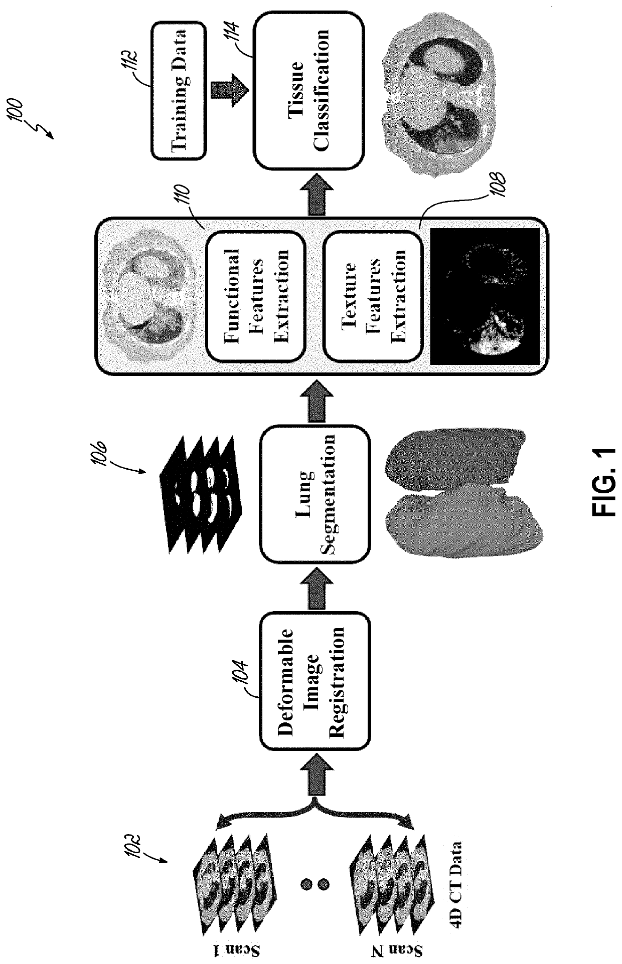 Accurate detection and assessment of radiation induced lung injury based on a computational model and computed tomography imaging