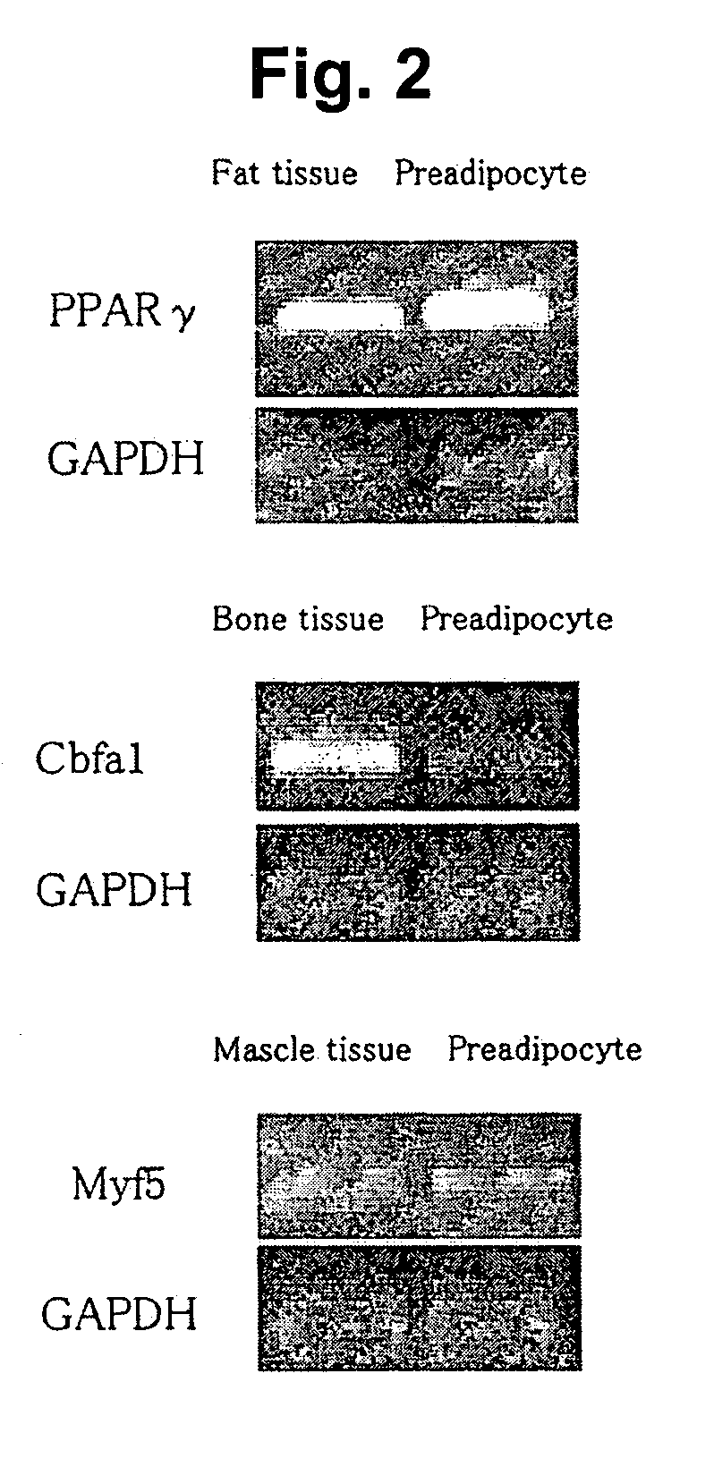 Differentiated Cells Originating in Precursor Fat Cells and Method of Acquiring the Same