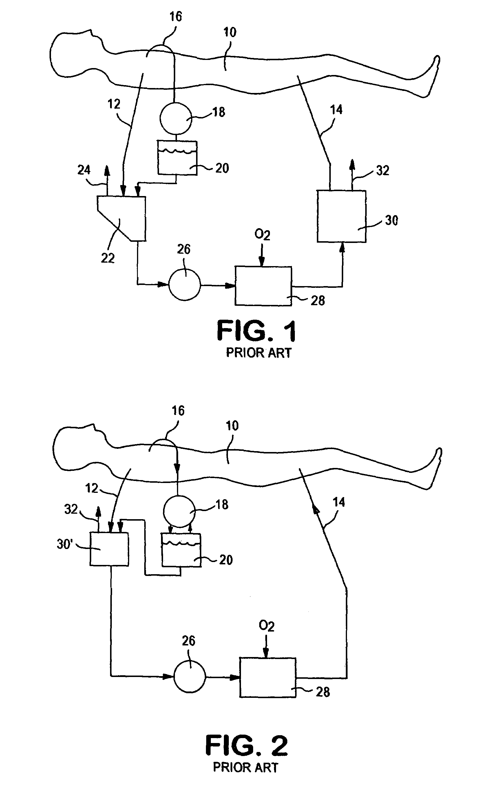 Disposable, integrated, extracorporeal blood circuit