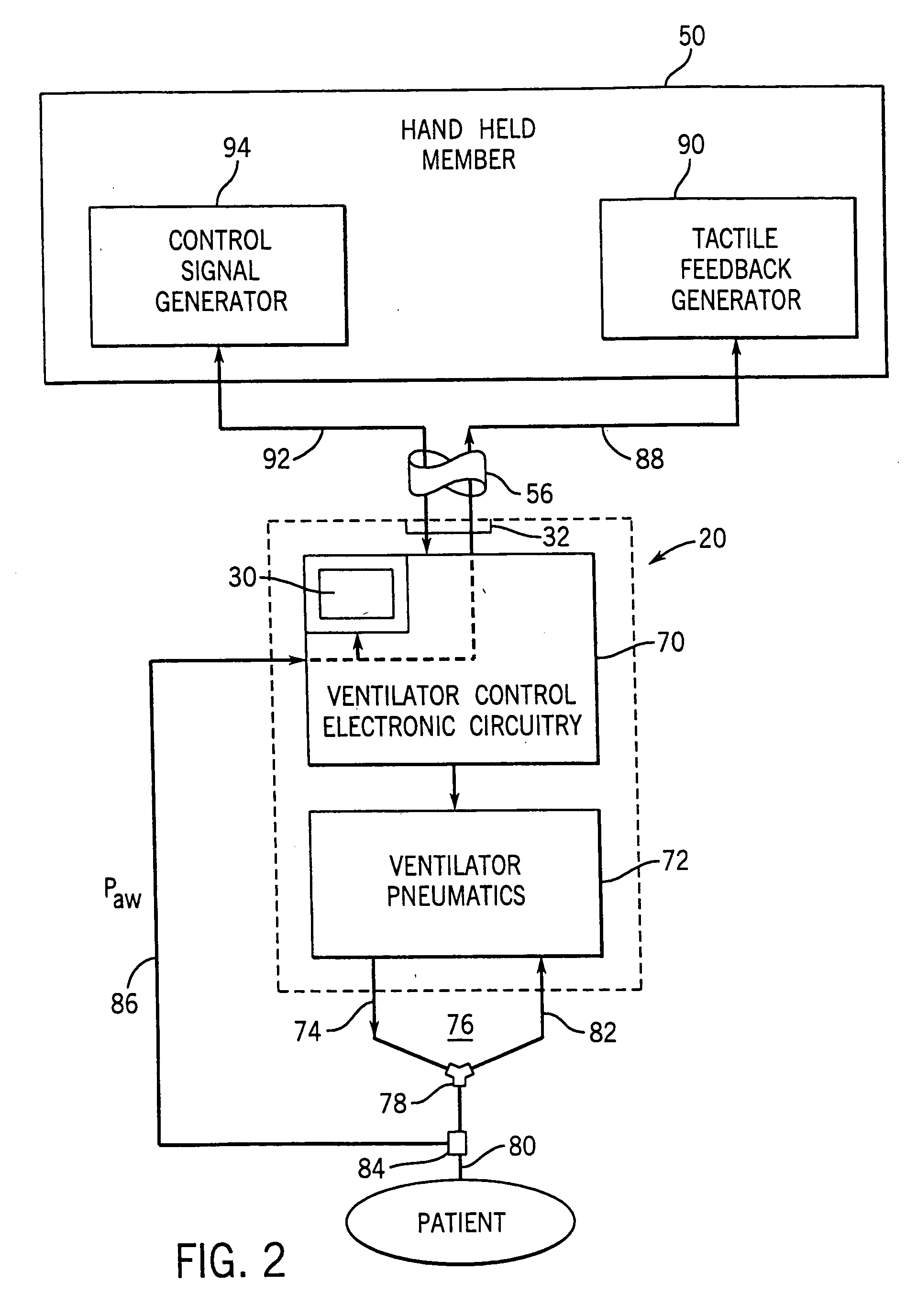 Remote control and tactile feedback system and method for medical apparatus