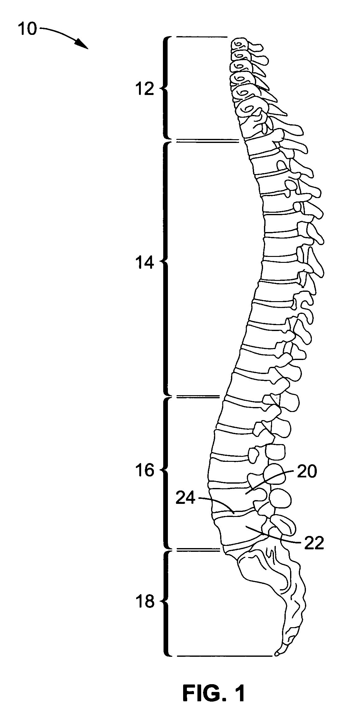 Spine microsurgery techniques, training aids and implants